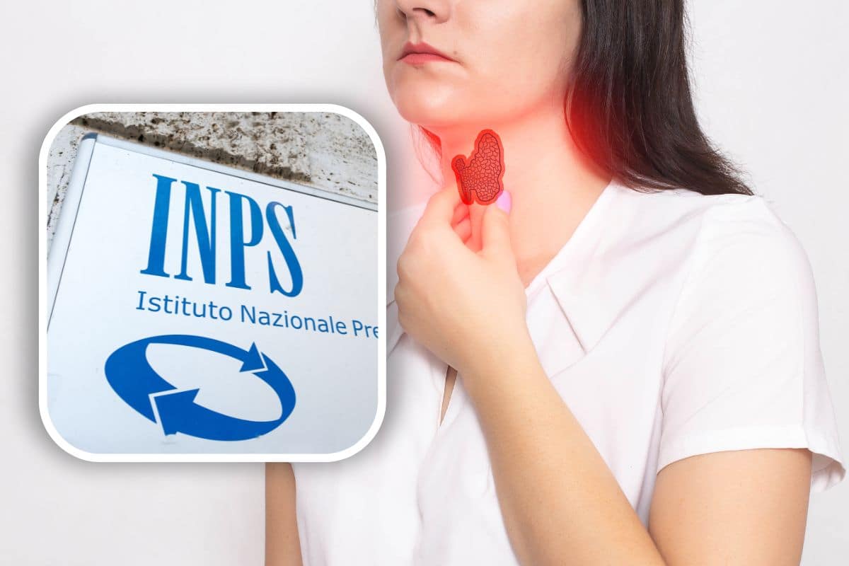 Bonus Tiroide INPS un forte sostegno in 3 fasce da chiedere subito e