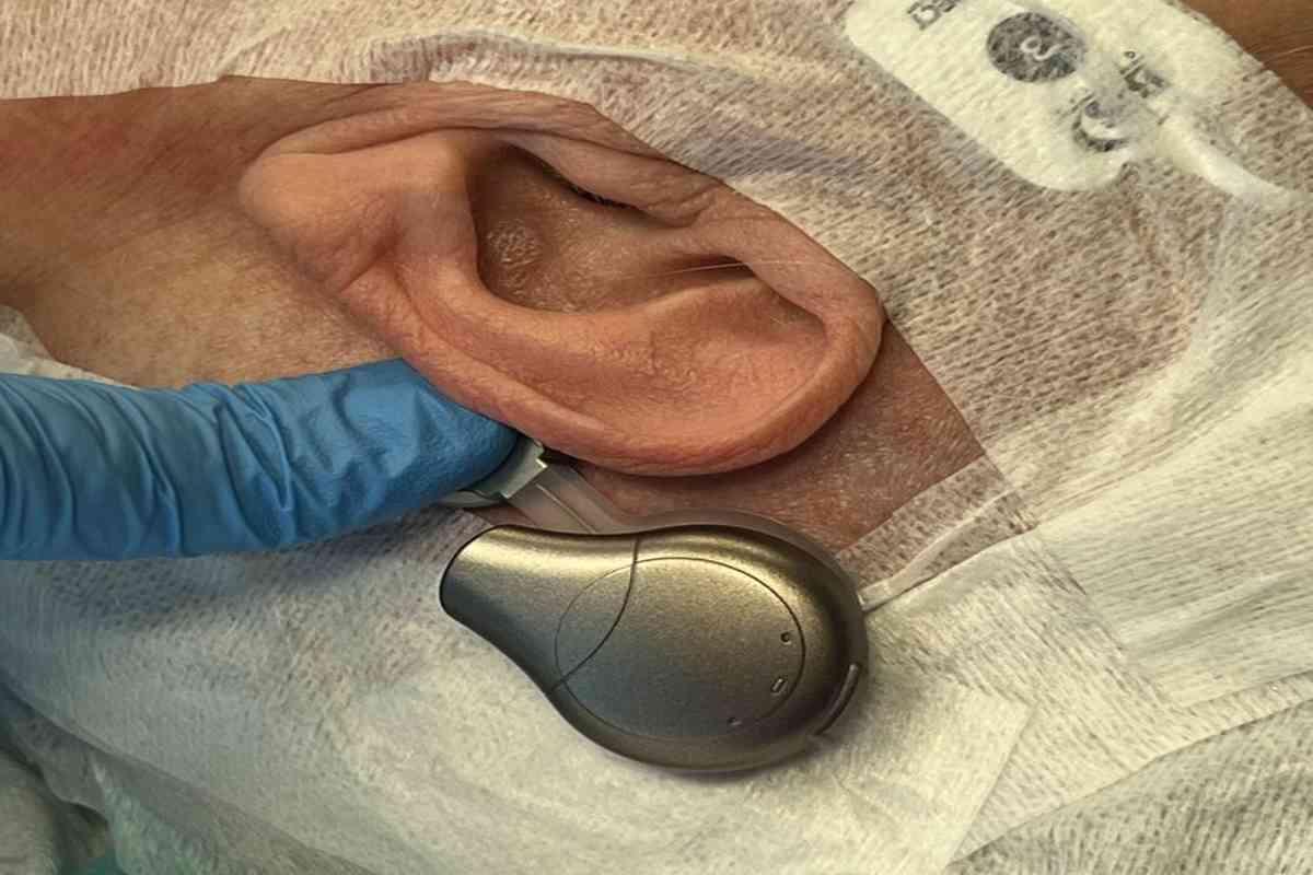 Ritorna a sentire: la rivoluzione del nuovo dispositivo impiantabile